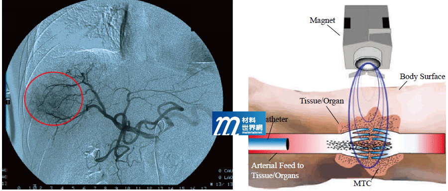 圖二、MTC-DOX之臨床應用MRI影像觀察以及於標靶與藥物傳輸示意