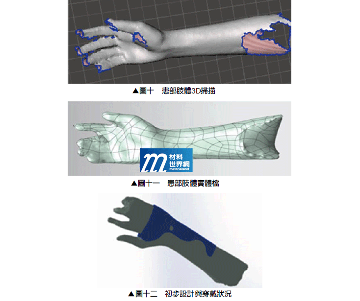 圖十、患部肢體3D掃描 & 圖十一、患部肢體實體檔 & 圖十二、初步設計與穿戴狀況