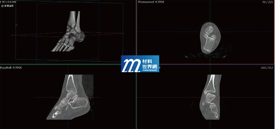圖二、透過醫療影像軟體將二維醫學影像重組為三維醫學影像
